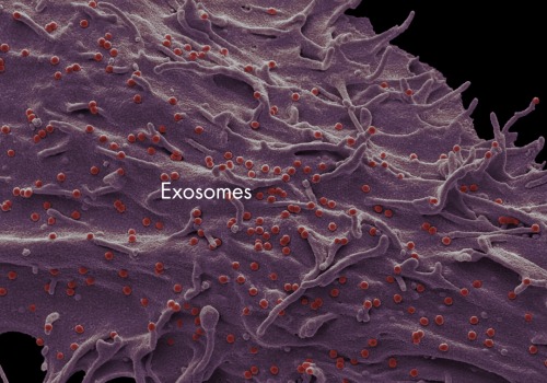 Are growth factors and exosomes the same thing?